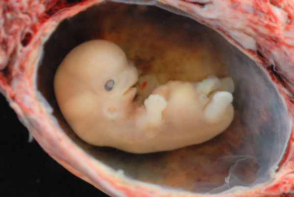 Foetus à 6 semaines de grossesse
